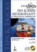 کتاب Tips and Tricks in Hip and Knee Arthroplasty2014 نکات و نکاتی در آرتروپلاستی مفصل ران و زانو