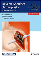 کتاب Reverse Shoulder Arthroplasty: A Practical Approach2017 آرتروپلاستی شانه معکوس: یک رویکرد عملی
