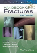 2020 Handbook of Fractures Sixth Edition کتابچه راهنمای شکستگی راکوود