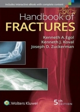 کتاب Handbook of Fractures