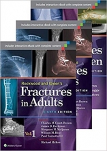 کتاب زبان فرکچرز این ادالتس اند چیلدرن Rockwood, Green, and Wilkins' Fractures in Adults and Children Package Eighth Edition (4V