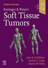 کتاب 2020 Enzinger and Weiss's Soft Tissue Tumors 7th Edition تومورهای بافت نرم