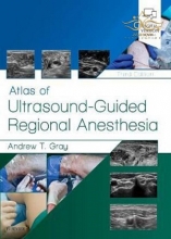 کتاب اطلس اف التراسوند Atlas of Ultrasound-Guided Regional Anesthesia