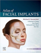 کتاب Atlas of Facial Implants 2nd Edition