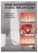 کتاب Bone Augmentation in Oral Implantology