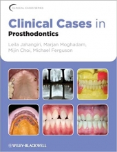 کتاب Clinical Cases in Prosthodontics 1st Edition