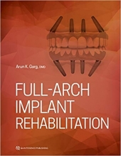 کتاب Full-Arch Implant Rehabilitation 1st Edition