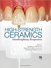 کتاب High-Strength Ceramics 1st Edition