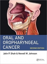 کتاب Oral and Oropharyngeal Cancer 2nd Edition