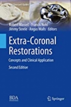 کتاب اکسترا کرونال رستوریشنز Extra-Coronal Restorations : Concepts and Clinical Application