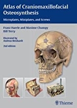 کتاب Atlas of Craniomaxillofacial Osteosynthesis : Microplates, Miniplates,and Screws