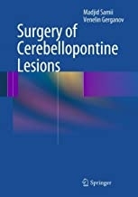 کتاب Surgery of Cerebellopontine Lesions2013