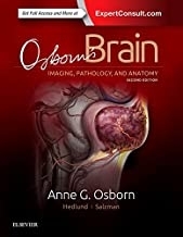 کتاب آزبورنز برین Osborn’s Brain, 2nd Edition2017