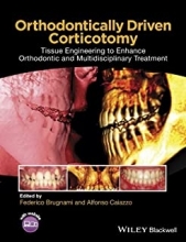 کتاب ارتودنتیکیلی دریون کورتیکوتومی Orthodontically Driven Corticotomy