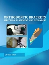 کتاب ارتودونتیک براکتس Orthodontic Brackets: Selection,Placement and Debonding2015