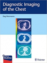 کتاب دیاگنوستیک ایمیجینگ آف د چست Diagnostic Imaging of the Chest2020