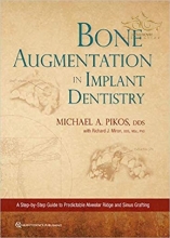 کتاب بون اوگمنتیشن این ایمپلنت دنتیستری Bone Augmentation in Implant Dentistry: A Step-by-Step Guide to Predictable Alveolar Rid