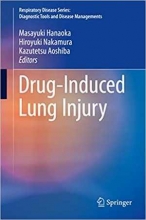 کتاب زبان دراگ ایندوسد لانگ اینجری Drug-Induced Lung Injury