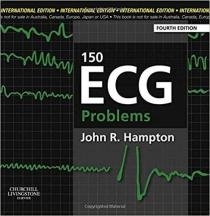 کتاب زبان ای سی جی پرابلم 150ECG problem