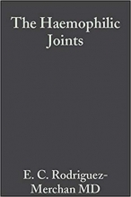 کتاب زبان د هموفیلیک جوینتس The Haemophilic Joints: New Perspectives