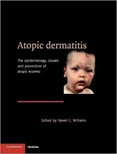 کتاب Atopic Dermatitis: The Epidemiology, Causes and Prevention of Atopic Eczema 1st Edition