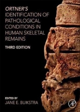 کتاب Ortner's Identification of Pathological Conditions in Human Skeletal Remains